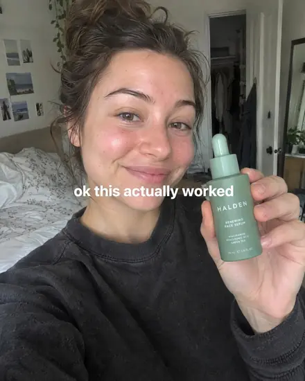 Phone selfie of a woman holding a serum bottle, caption 'ok this actually worked'